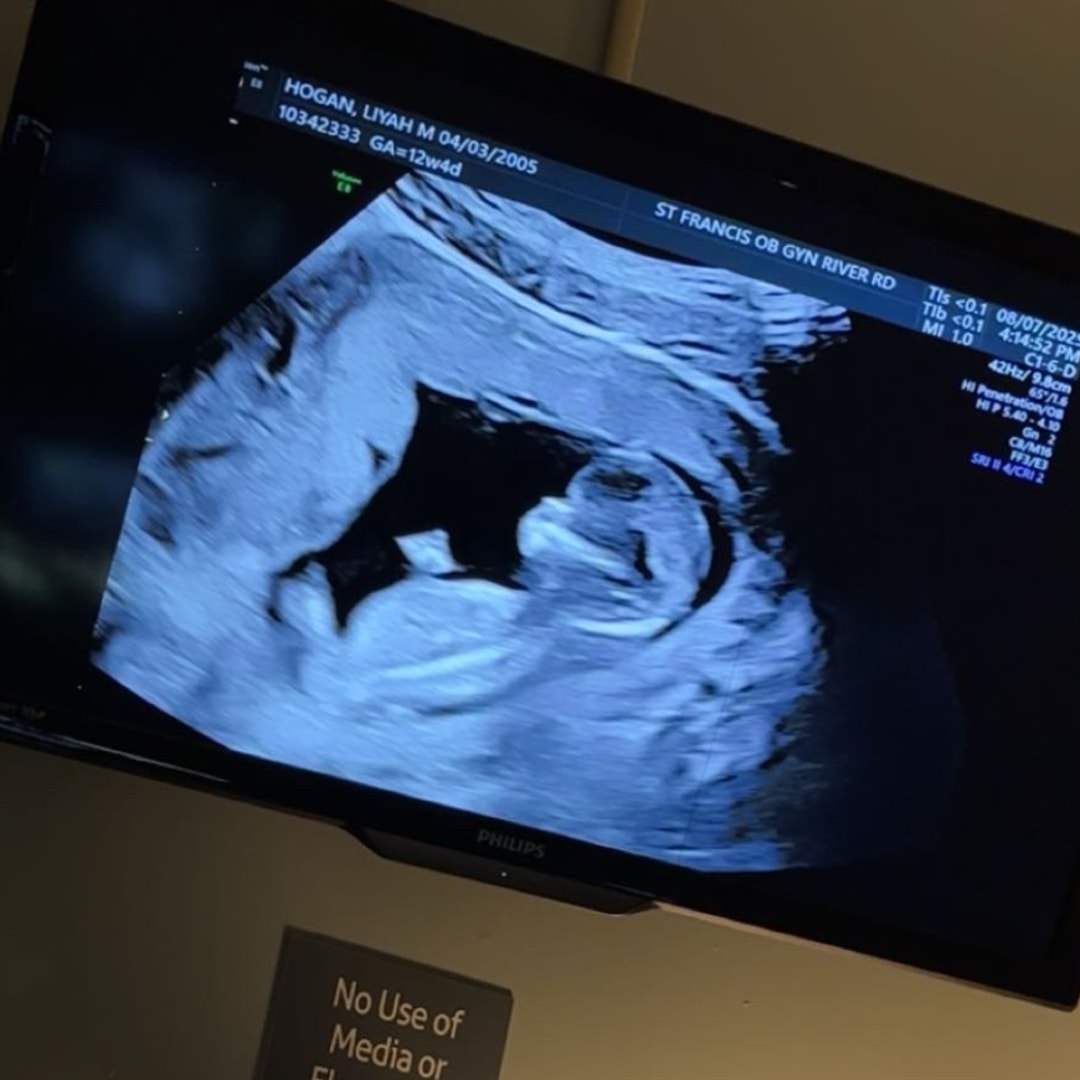 Photo shared by Liyah for their Babylist baby registry.