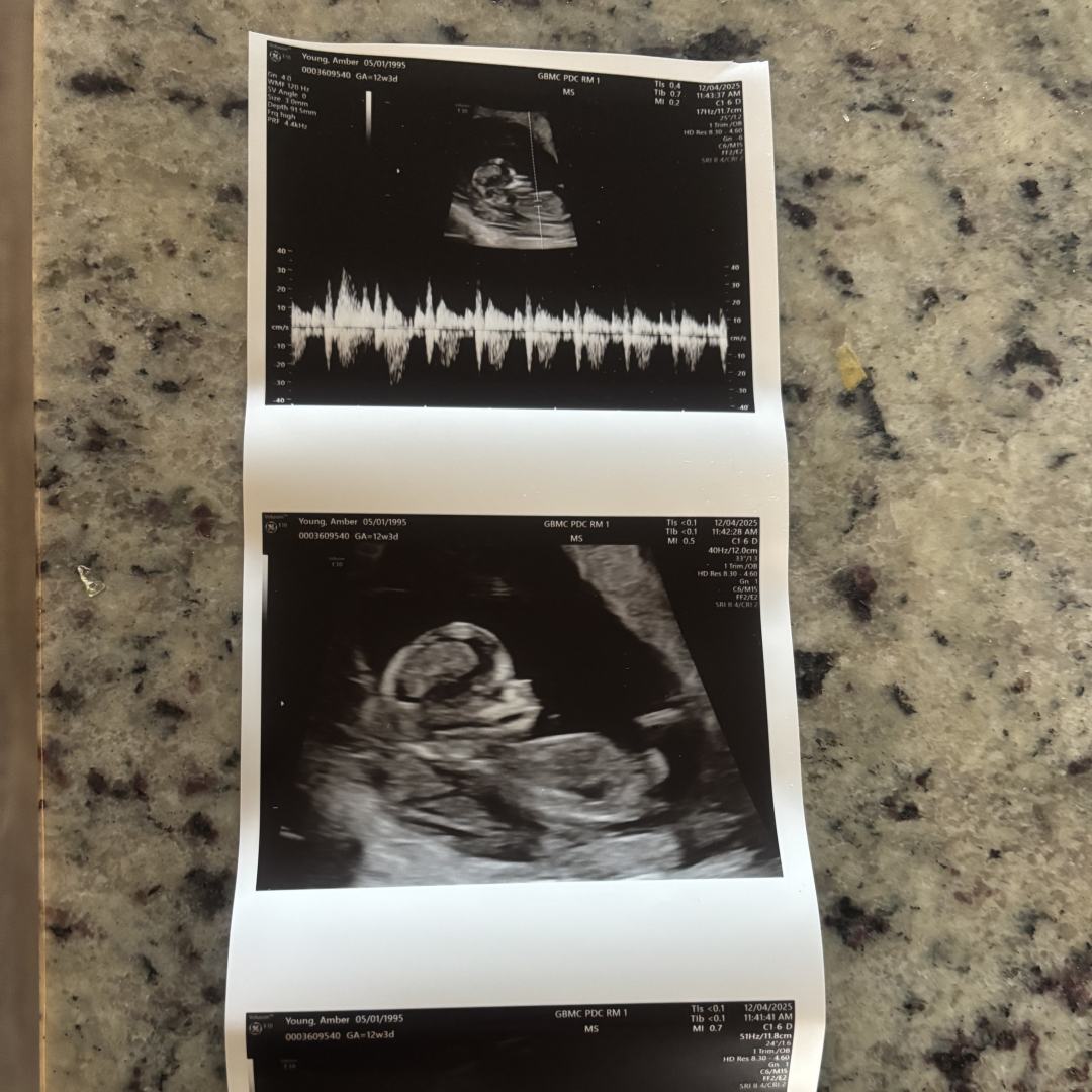 Photo shared by Amber for their Babylist baby registry.