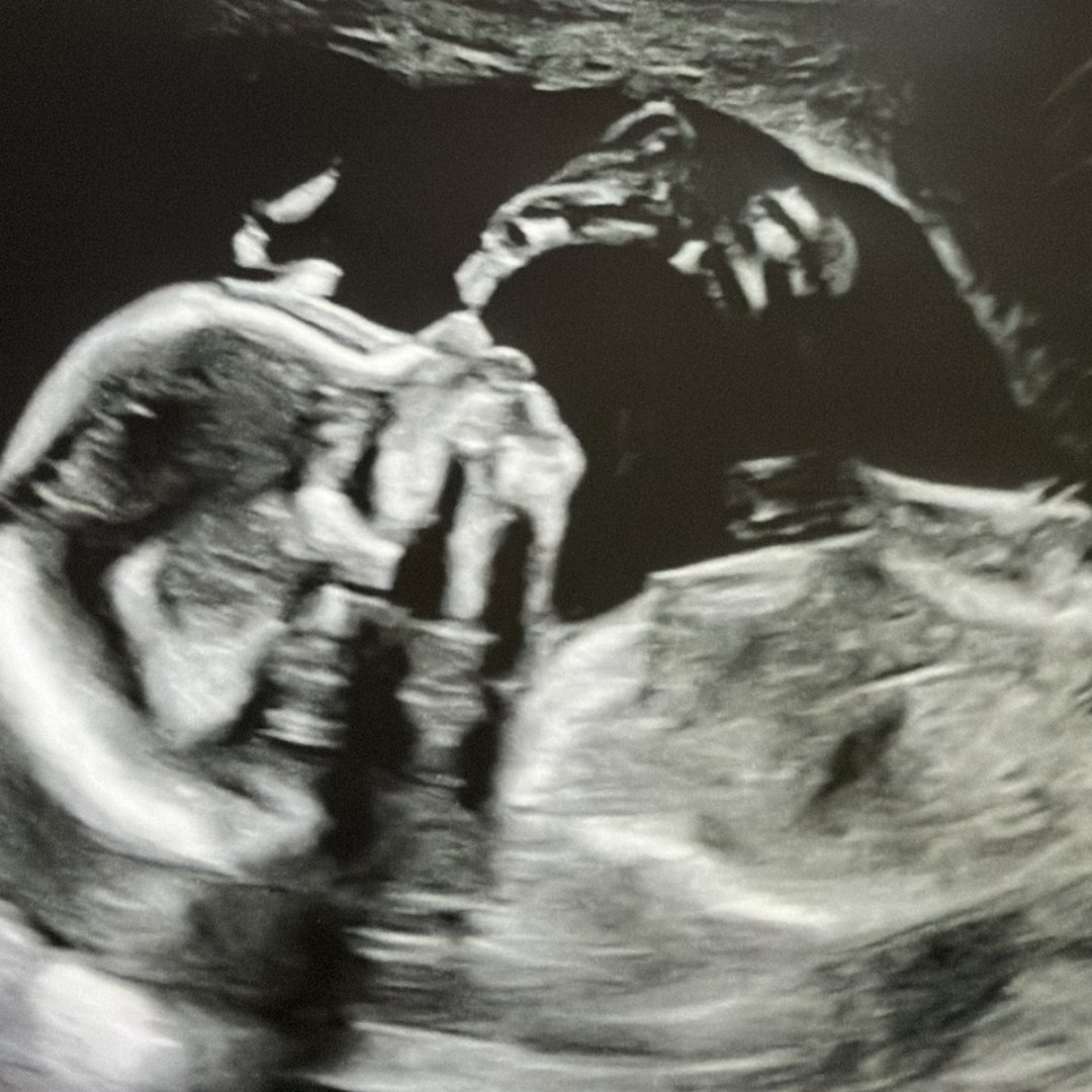 Photo shared by Erica for their Babylist baby registry.