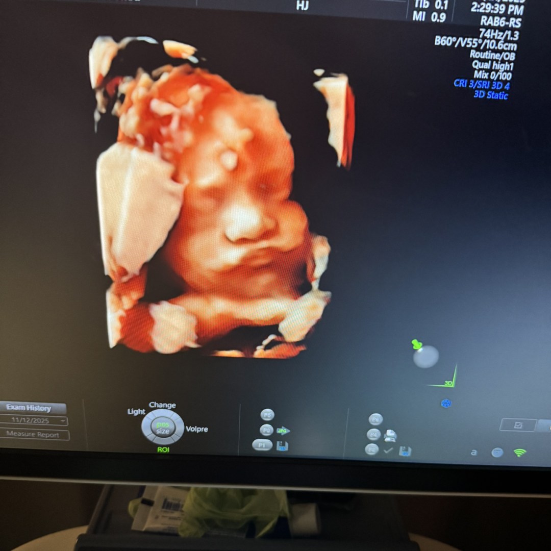 Photo shared by Rosario for their Babylist baby registry.