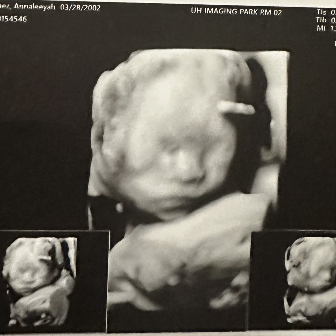 Photo shared by Annaleeyah for their Babylist baby registry.