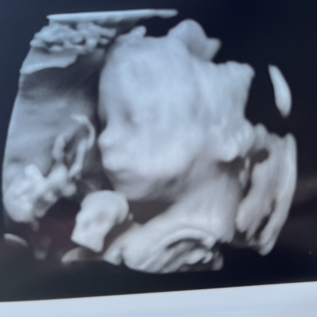 Photo shared by Emily for their Babylist baby registry.
