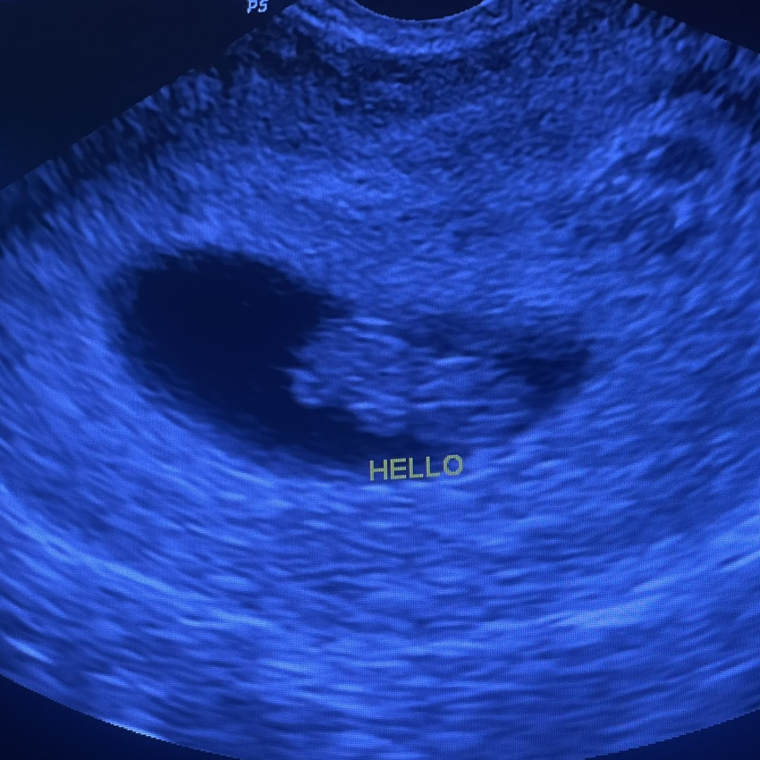 Photo shared by Claudia for their Babylist baby registry.