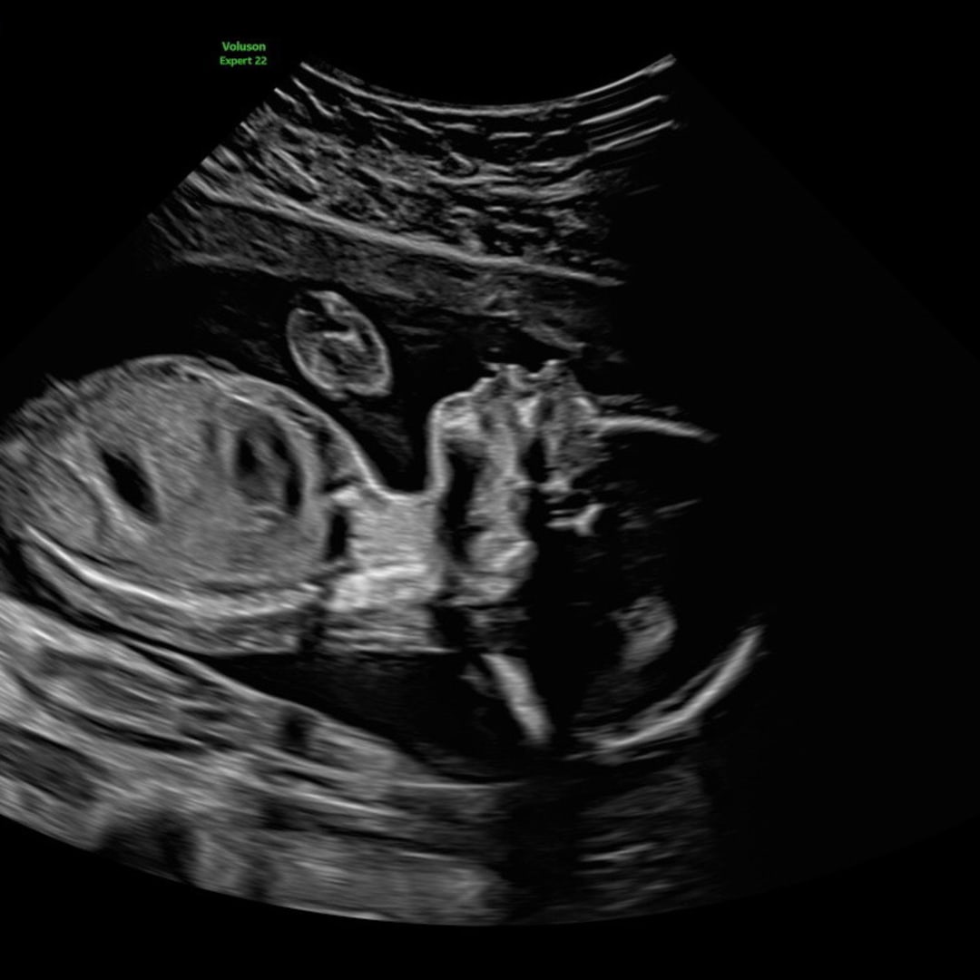 Photo shared by Nikia for their Babylist baby registry.