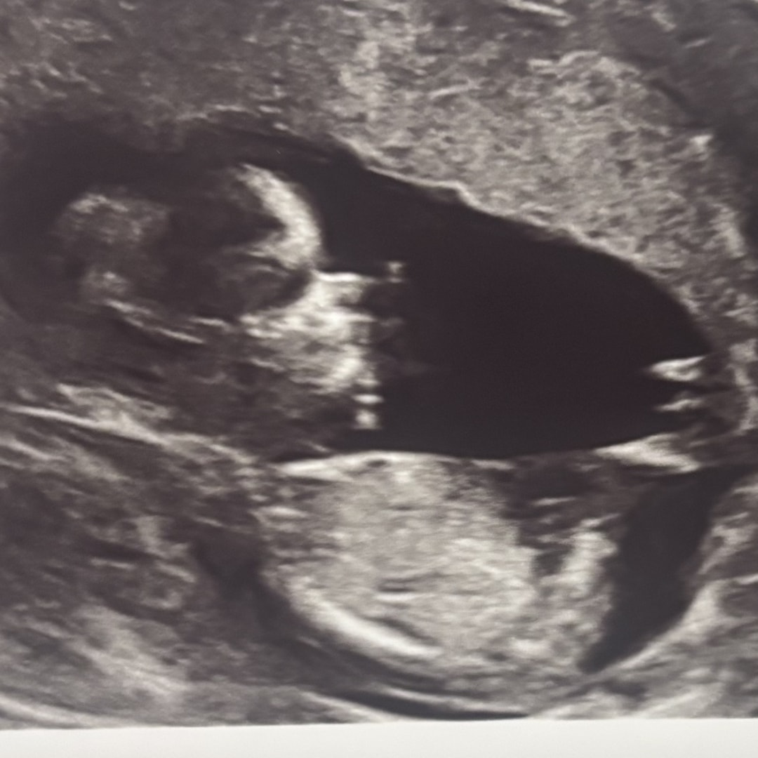 Photo shared by Vanessa for their Babylist baby registry.