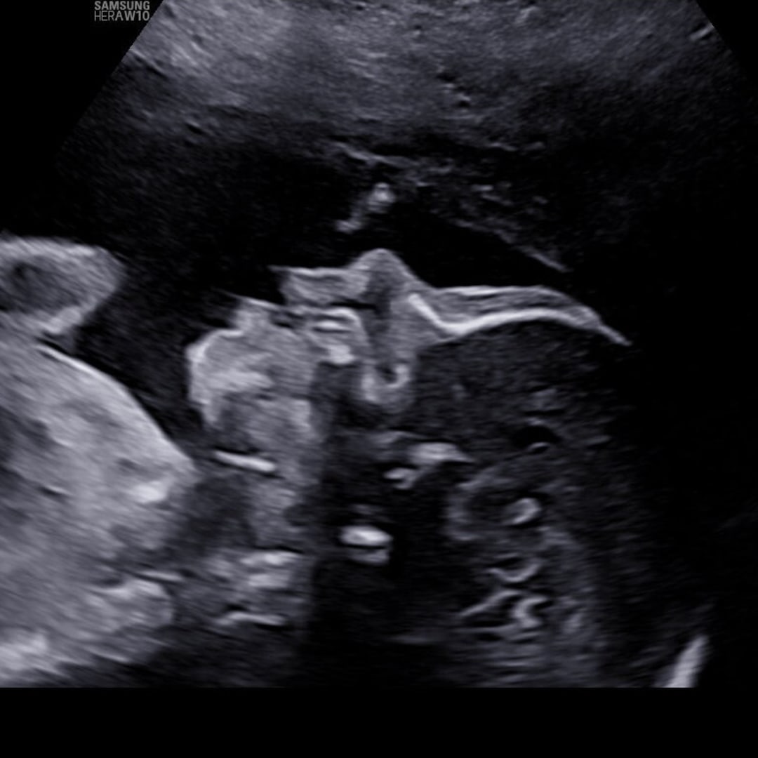 Photo shared by Jordyn for their Babylist baby registry.