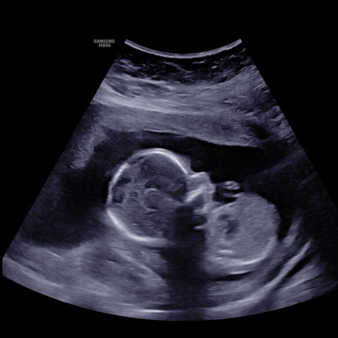 Photo shared by Alexis for their Babylist baby registry.