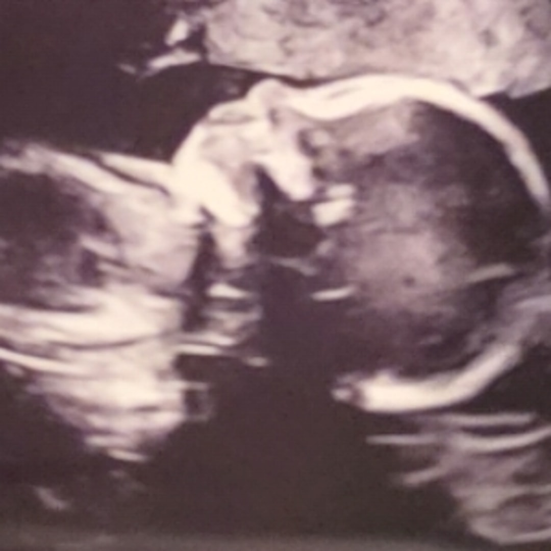 Photo shared by Cindy for their Babylist baby registry.