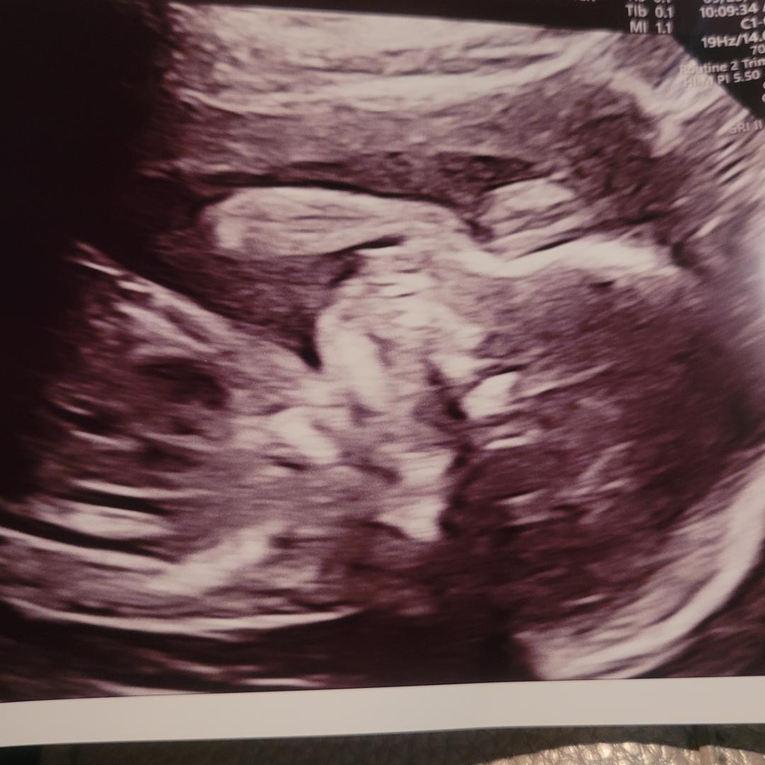 Photo shared by Becky for their Babylist baby registry.