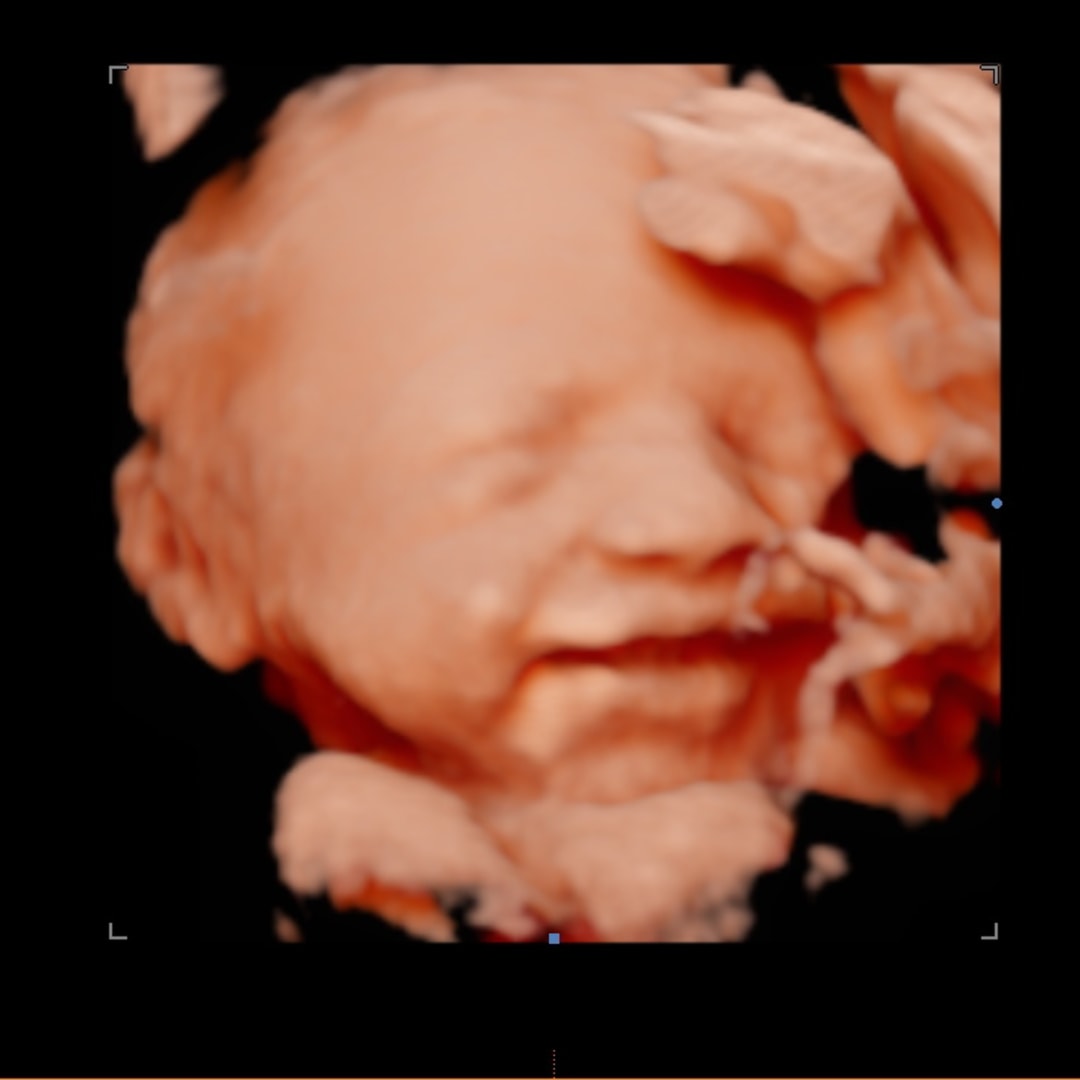 Photo shared by Dominique for their Babylist baby registry.