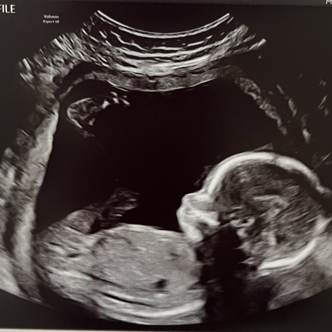 Photo shared by Paula for their Babylist baby registry.