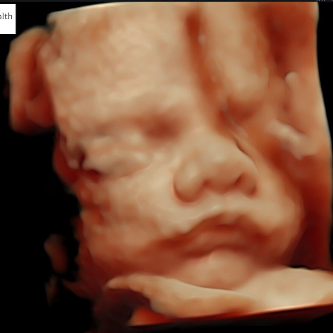 Photo shared by Alyssa for their Babylist baby registry.