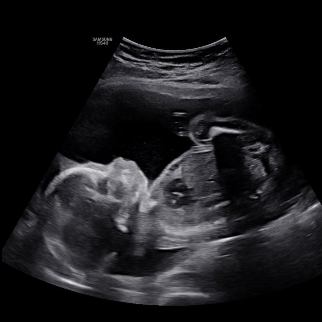 Photo shared by Ruth for their Babylist baby registry.