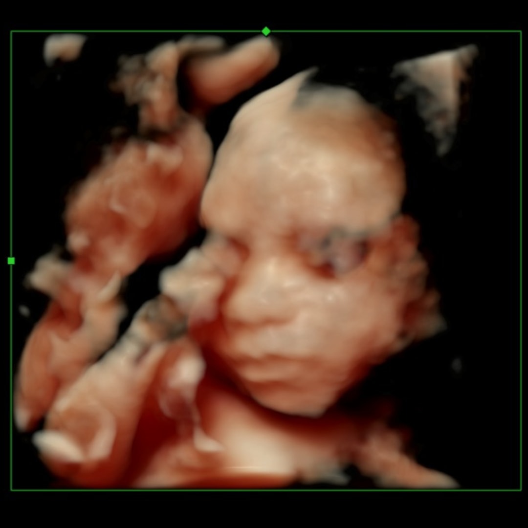 Photo shared by Lizmarie for their Babylist baby registry.