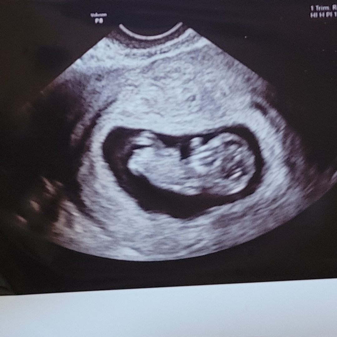 Photo shared by Camila for their Babylist baby registry.