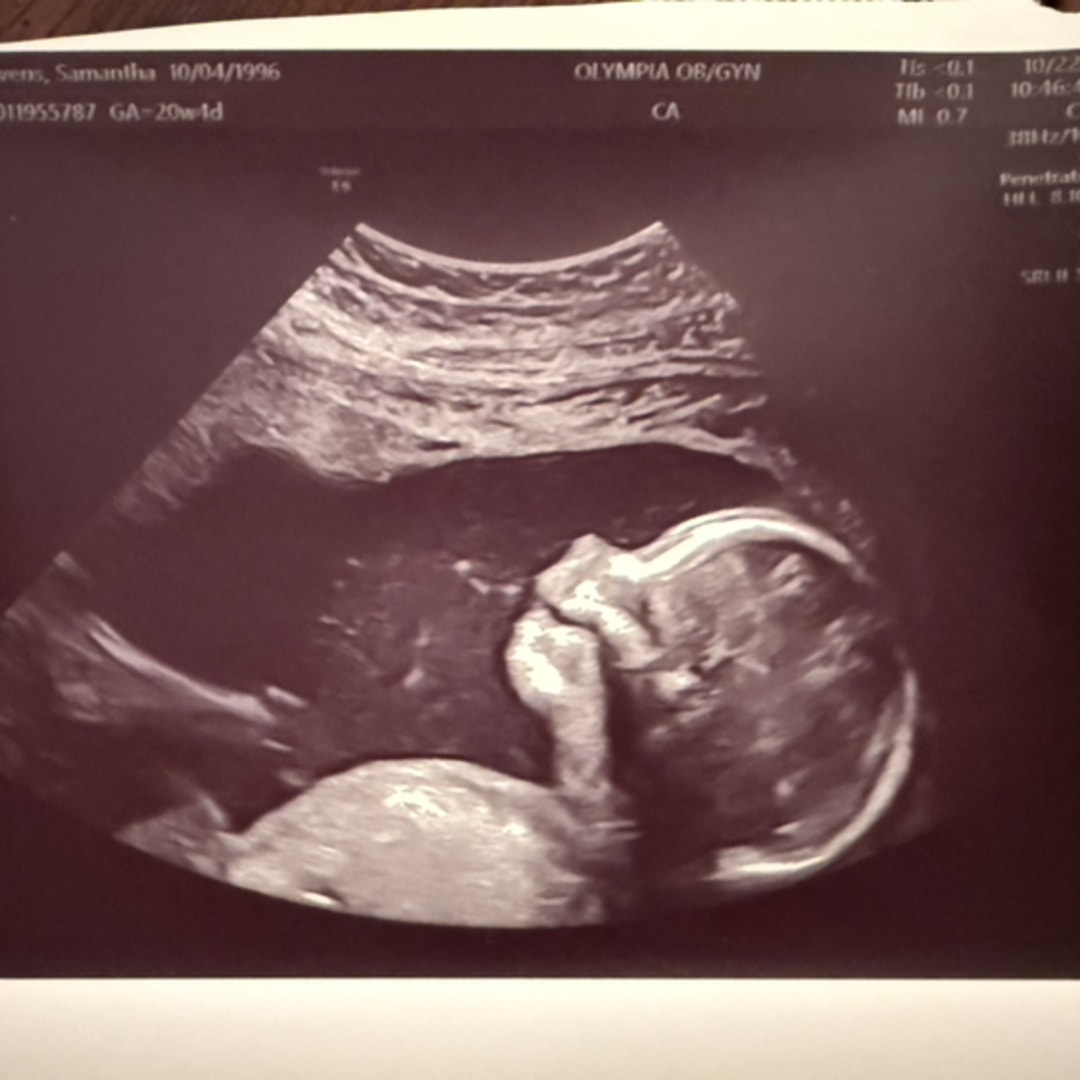 Photo shared by Samantha for their Babylist baby registry.