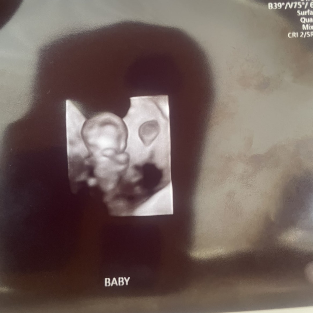Photo shared by Mckenzie for their Babylist baby registry.