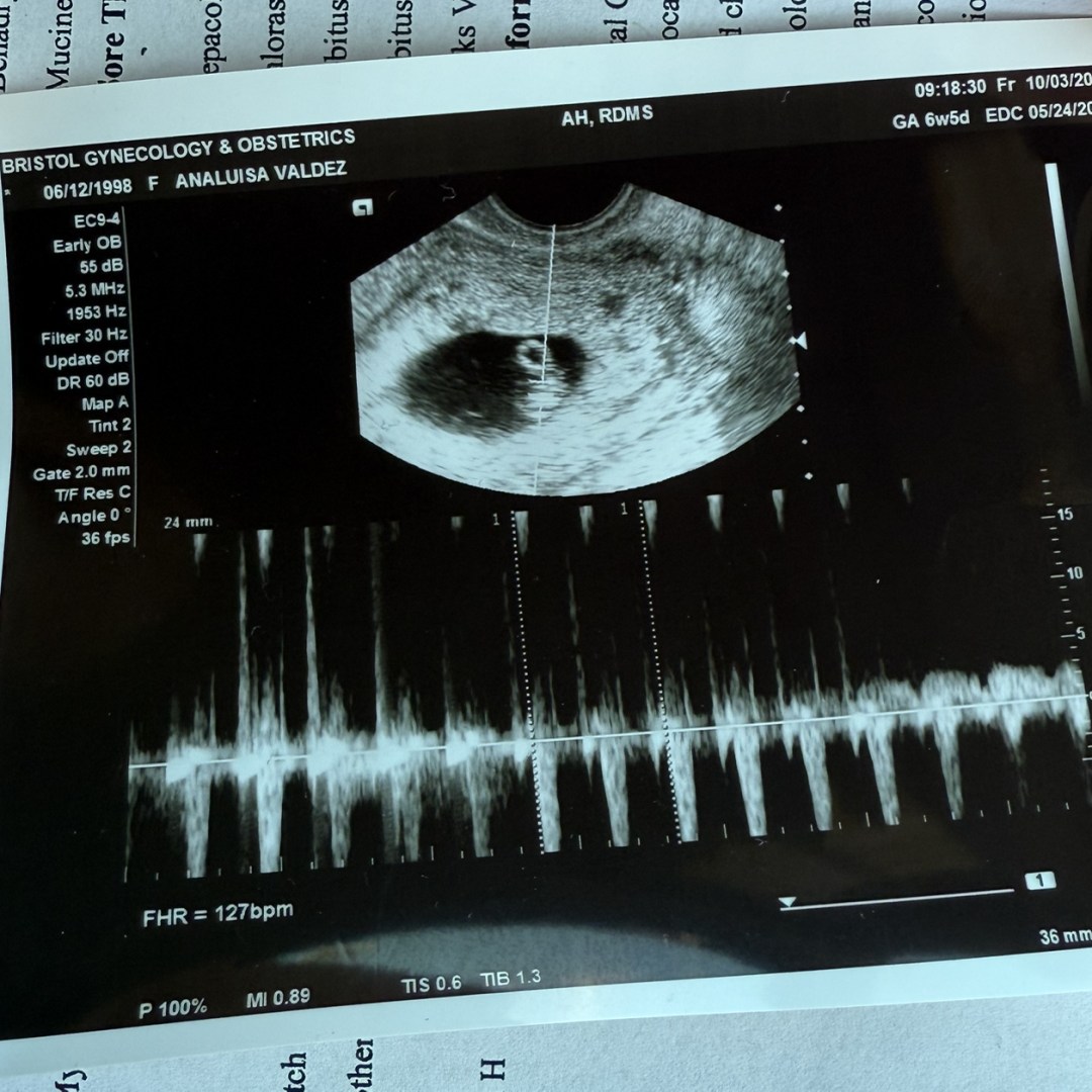 Photo shared by Luisa for their Babylist baby registry.