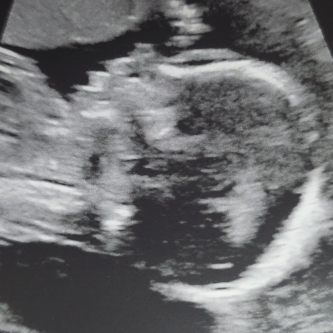 Photo shared by Morgan for their Babylist baby registry.