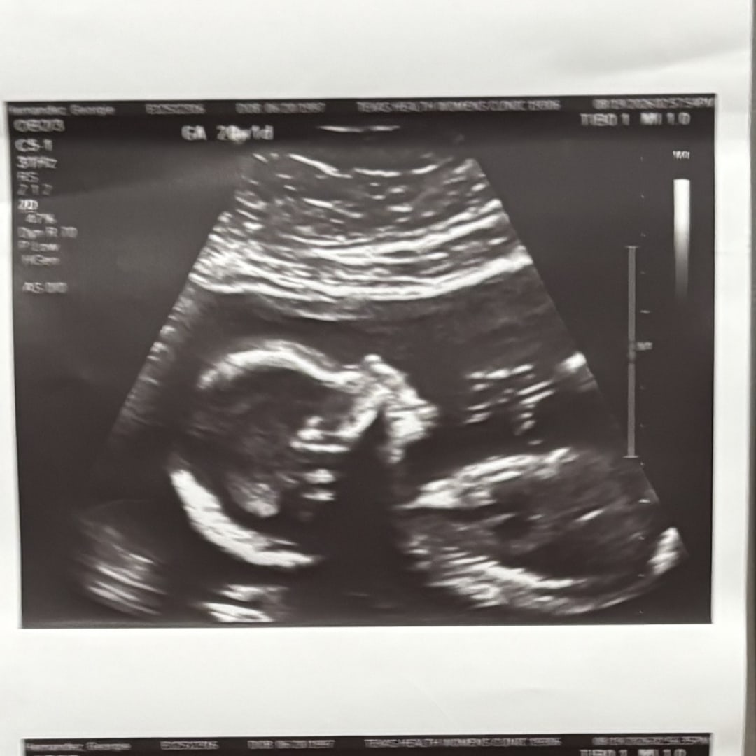 Photo shared by Georgie for their Babylist baby registry.