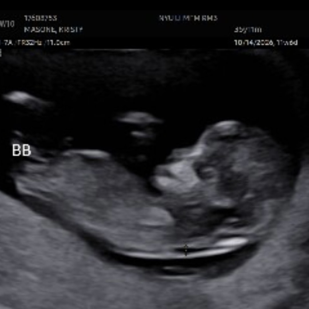 Photo shared by Kristy for their Babylist baby registry.