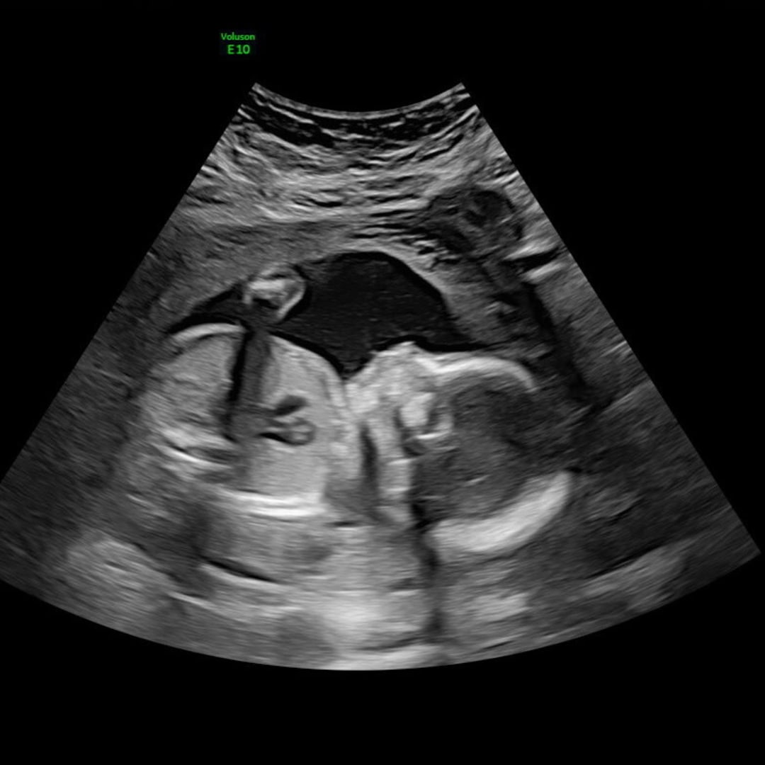 Photo shared by Grace for their Babylist baby registry.