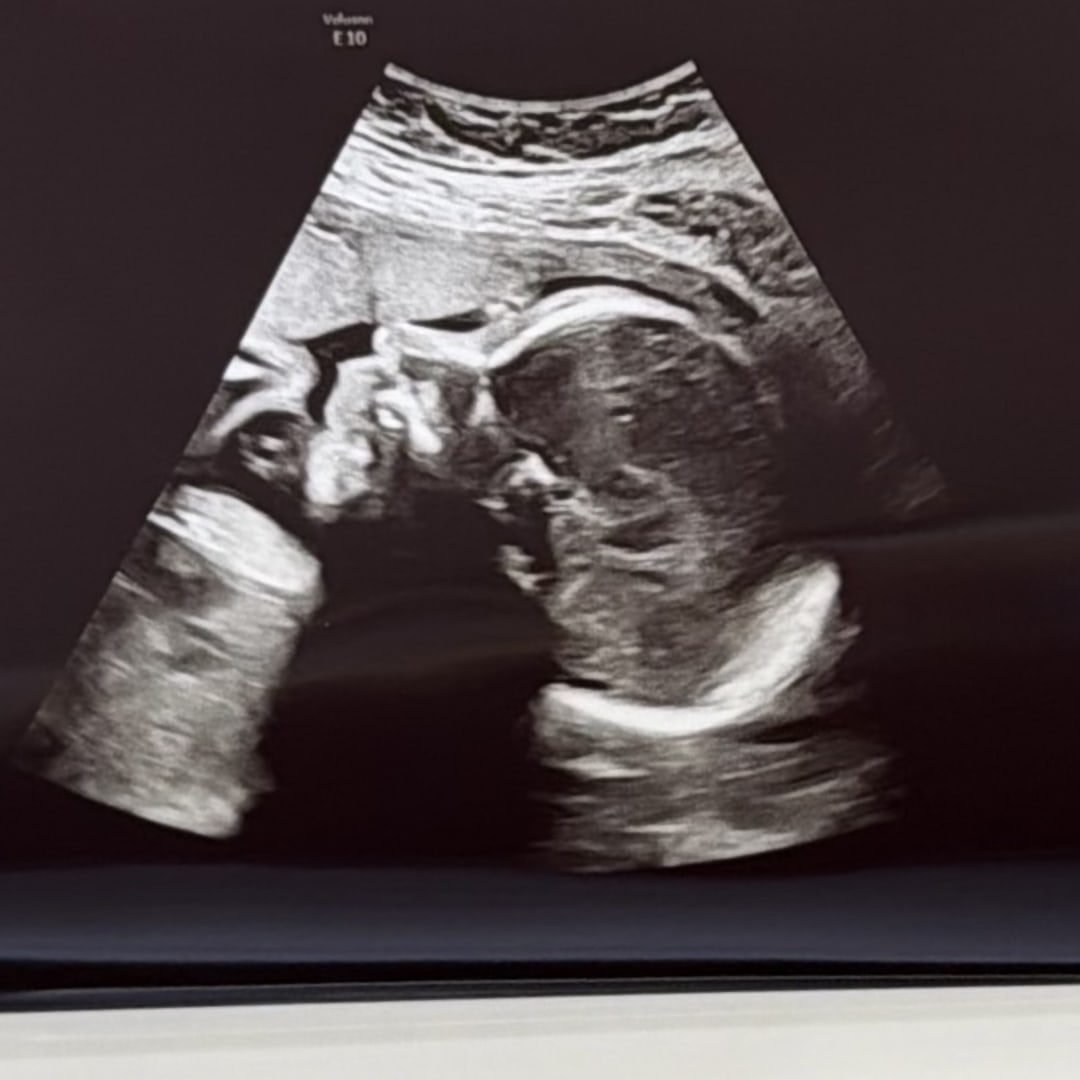 Photo shared by Mariel for their Babylist baby registry.