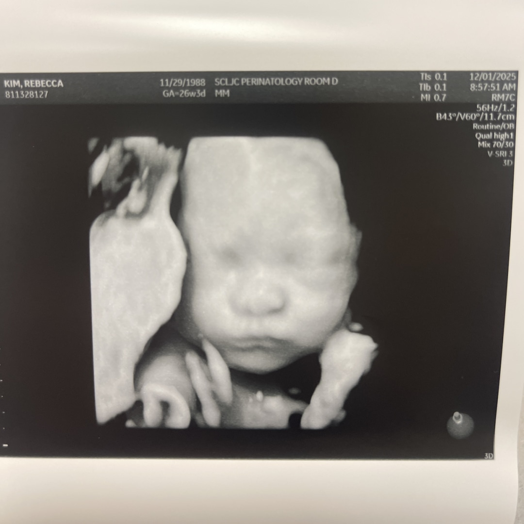 Photo shared by Rebecca for their Babylist baby registry.