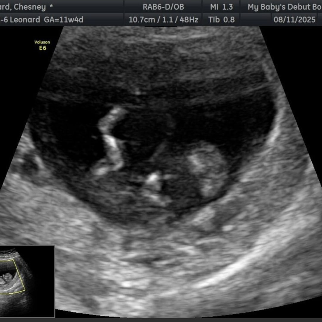 Photo shared by Chesney for their Babylist baby registry.