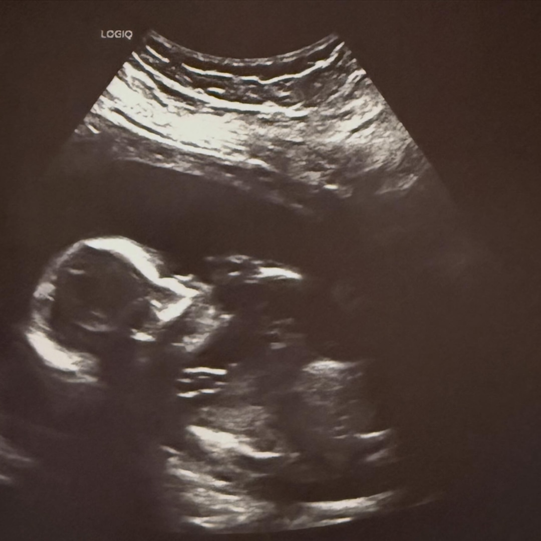 Photo shared by Jillian for their Babylist baby registry.