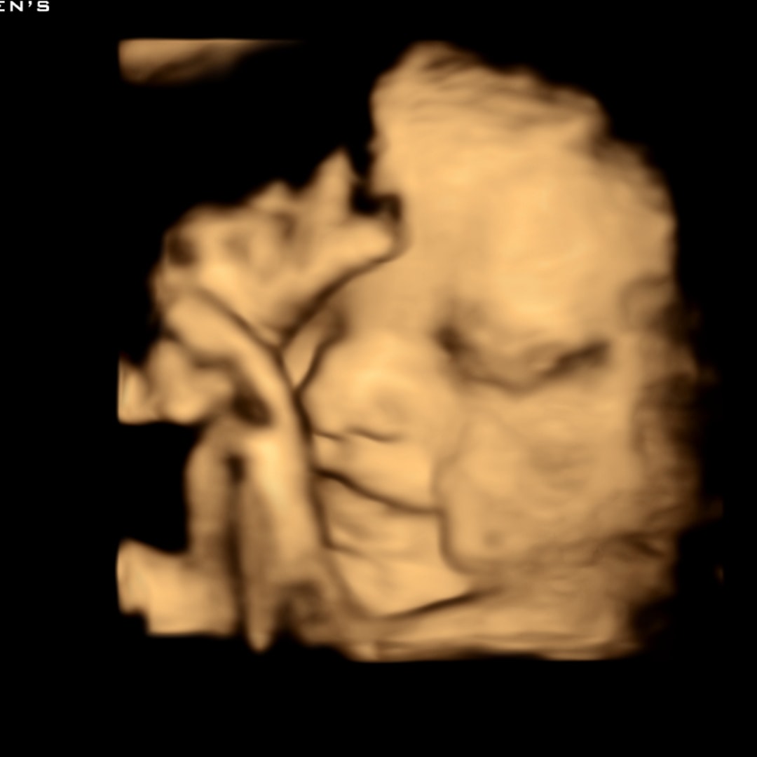 Photo shared by Hunter for their Babylist baby registry.