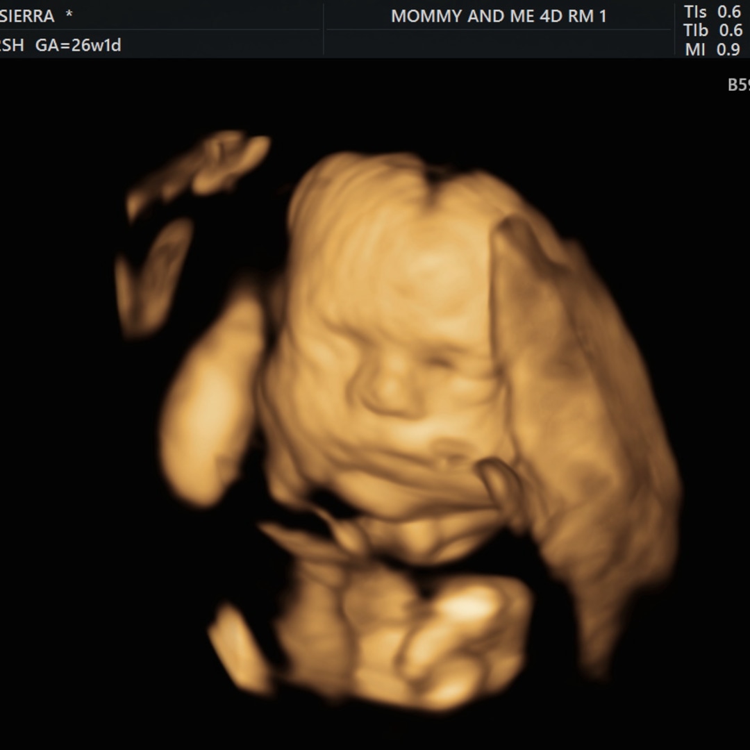 Photo shared by Sierra for their Babylist baby registry.