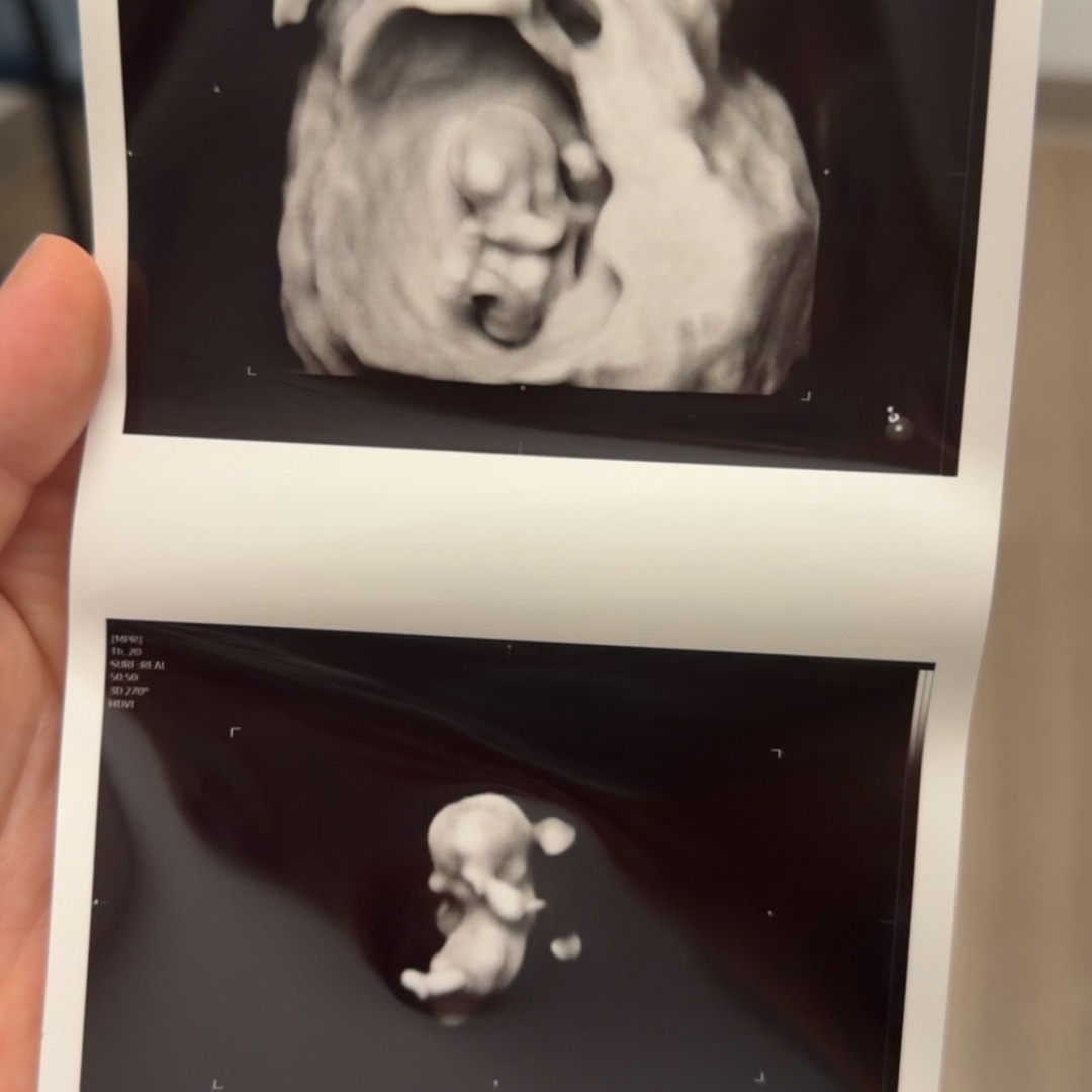 Photo shared by Alyson for their Babylist baby registry.