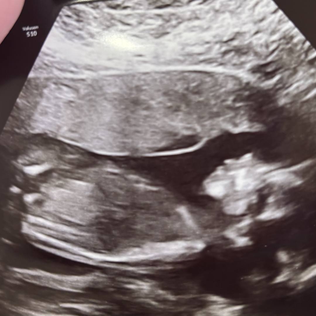 Photo shared by Ashli for their Babylist baby registry.