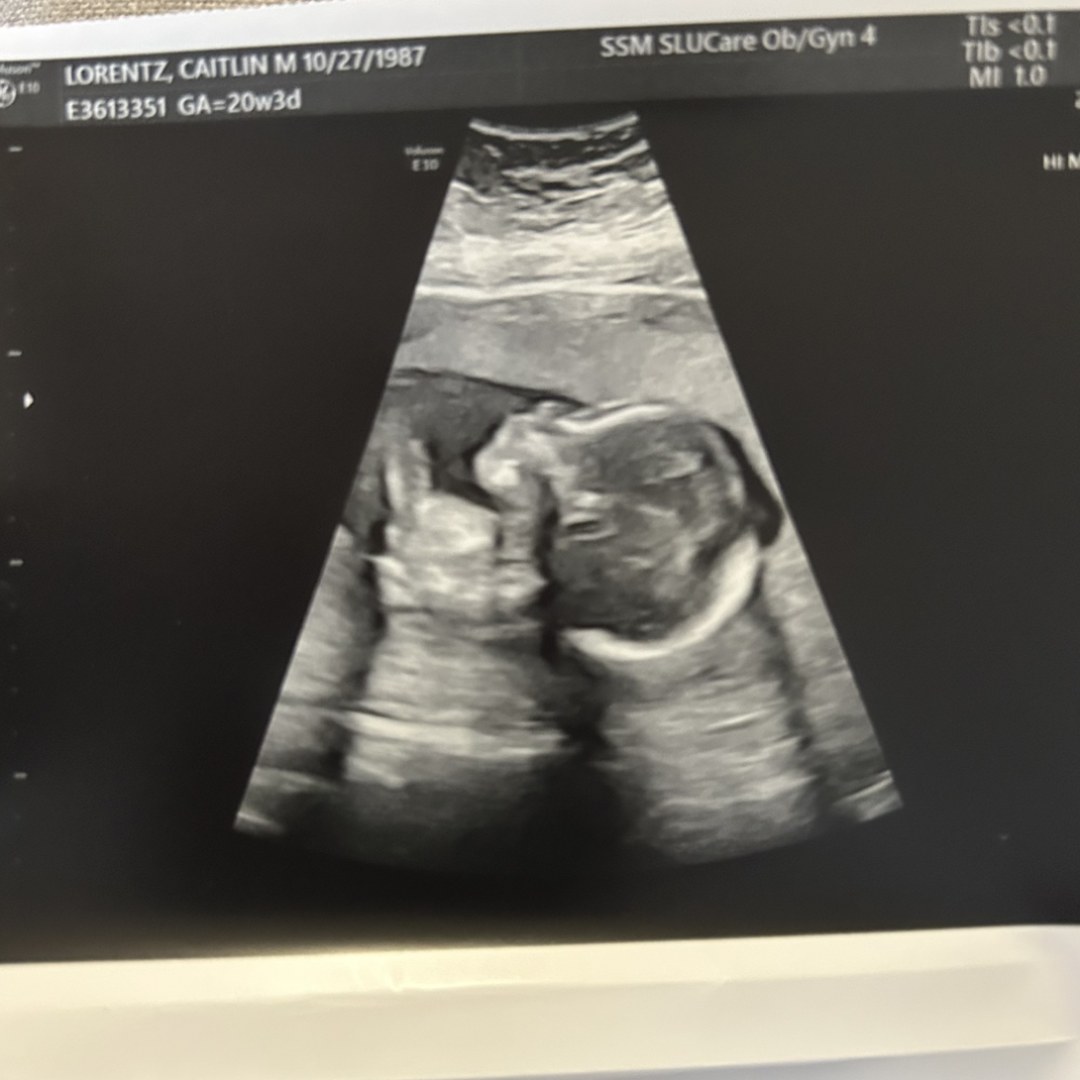 Photo shared by Caitlin for their Babylist baby registry.