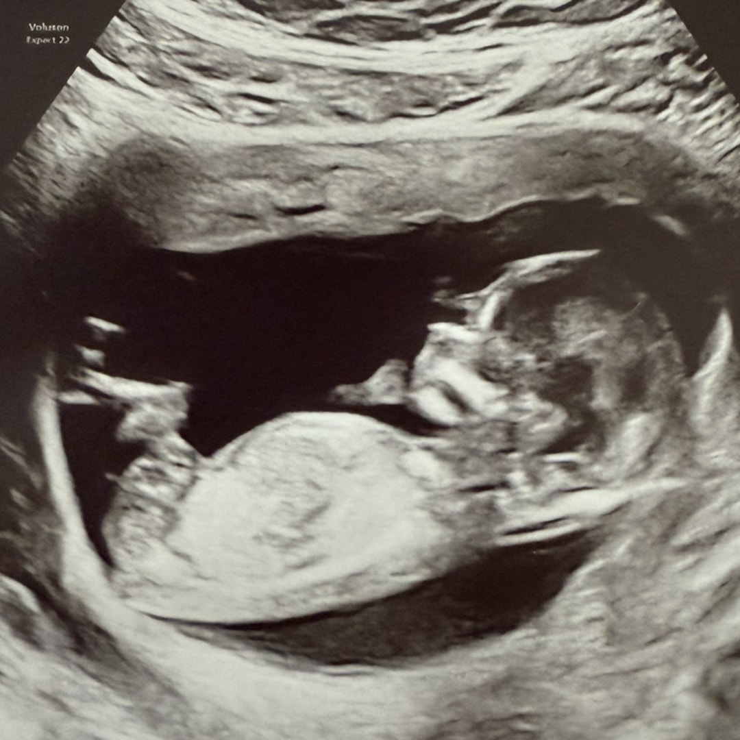 Photo shared by Erica for their Babylist baby registry.