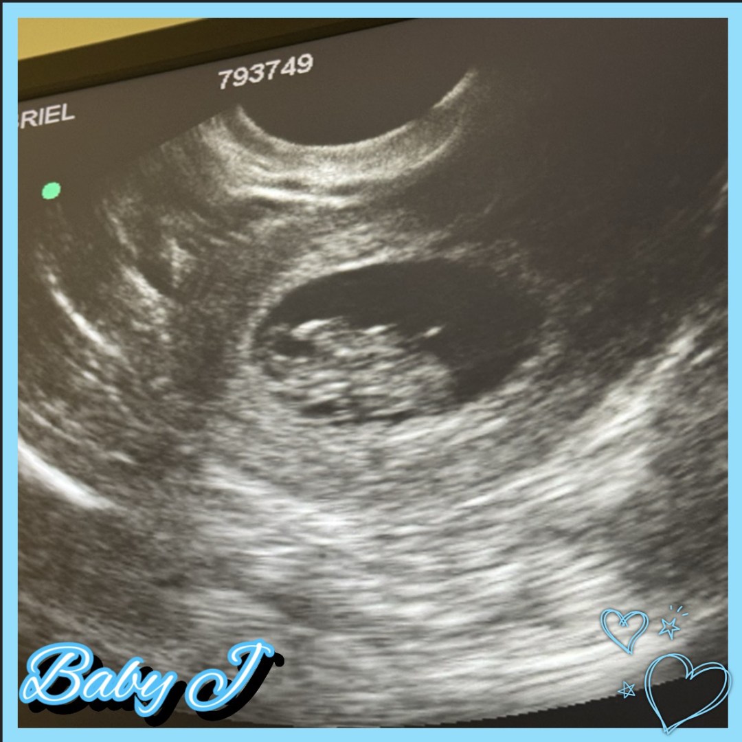 Photo shared by Gabriel for their Babylist baby registry.