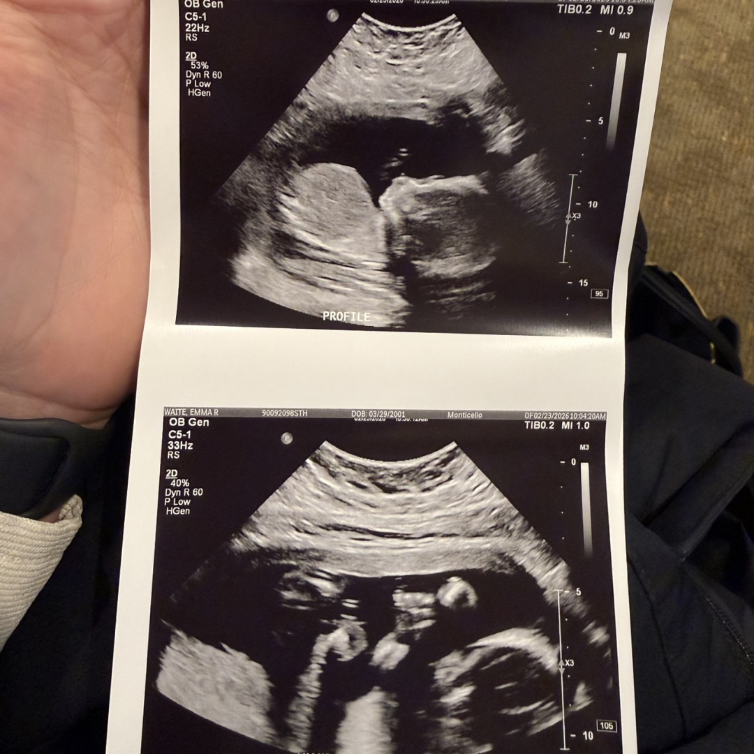 Photo shared by Emma for their Babylist baby registry.