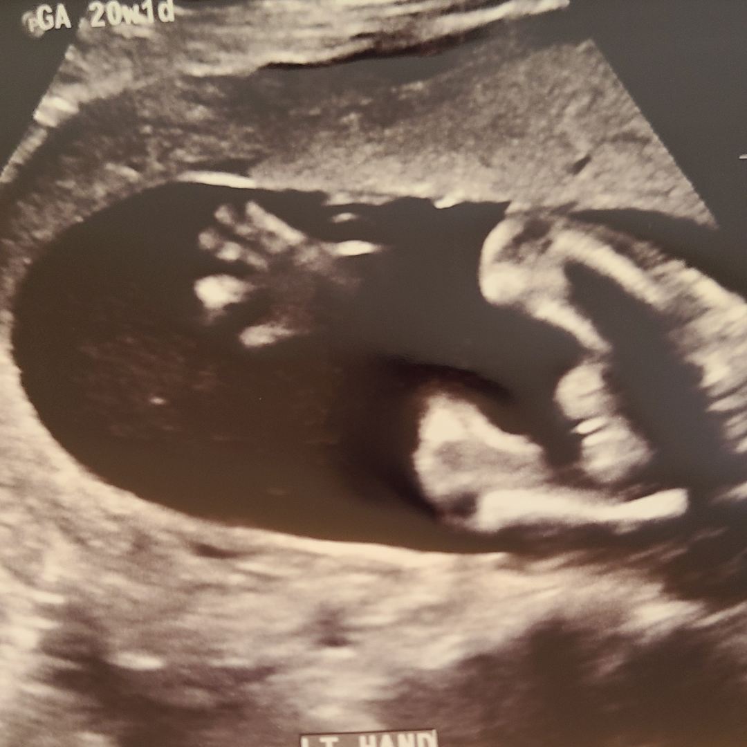 Photo shared by Nicolette for their Babylist baby registry.