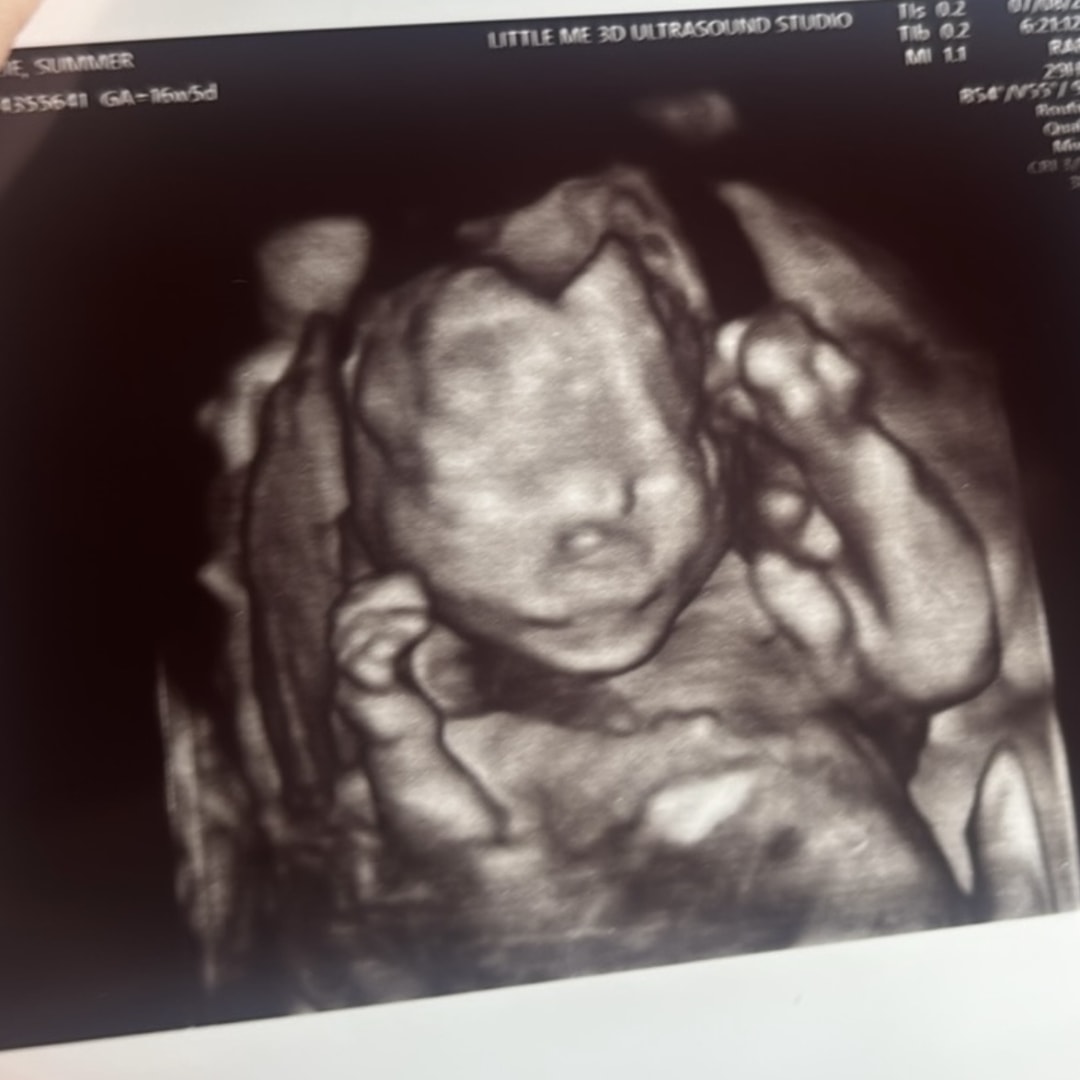 Photo shared by Summer for their Babylist baby registry.