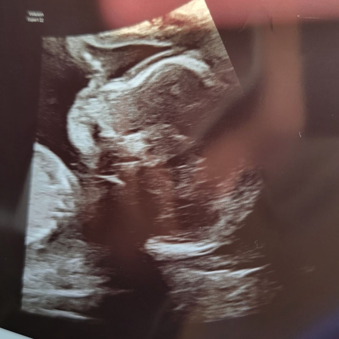 Photo shared by Marissa for their Babylist baby registry.