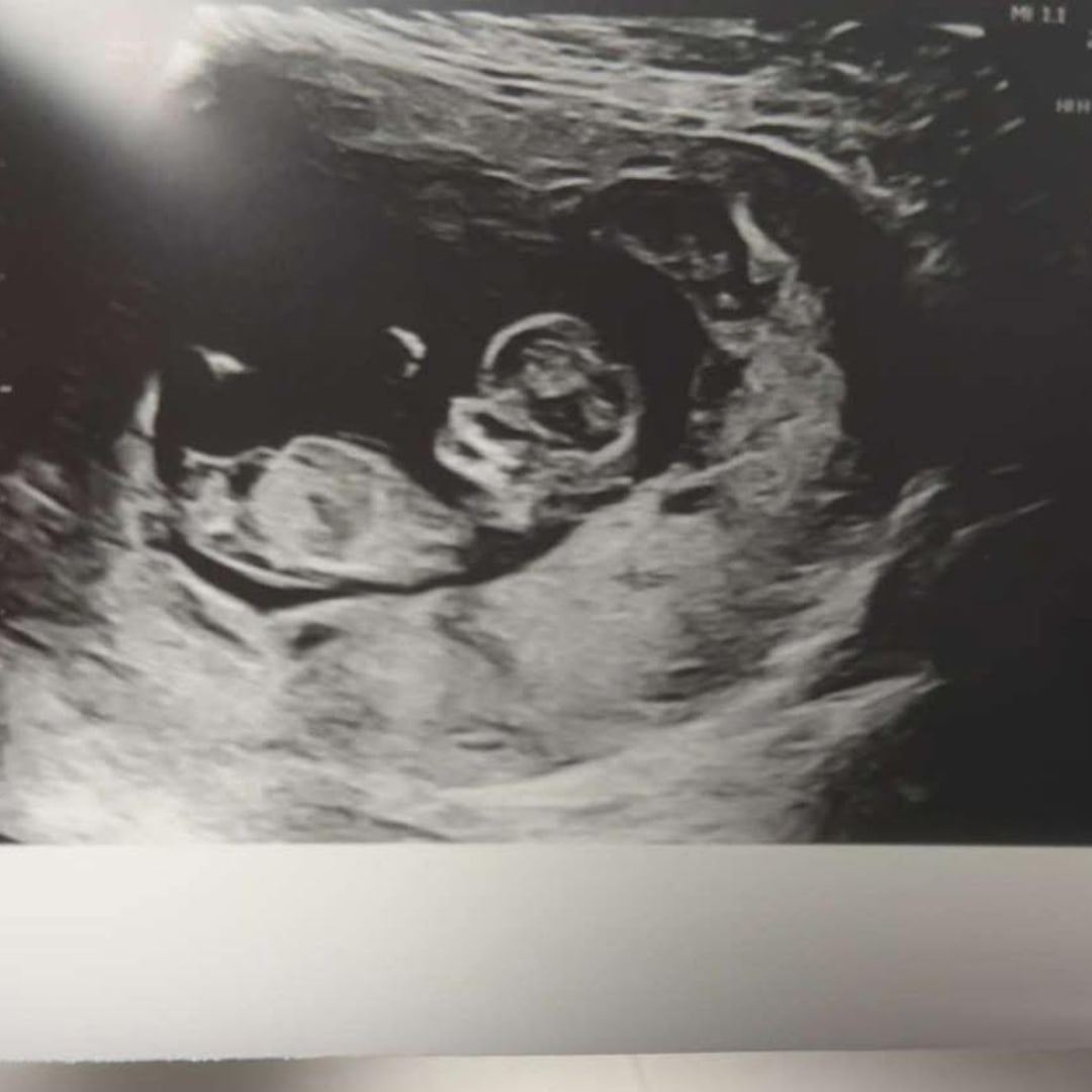 Photo shared by RayeAnne for their Babylist baby registry.