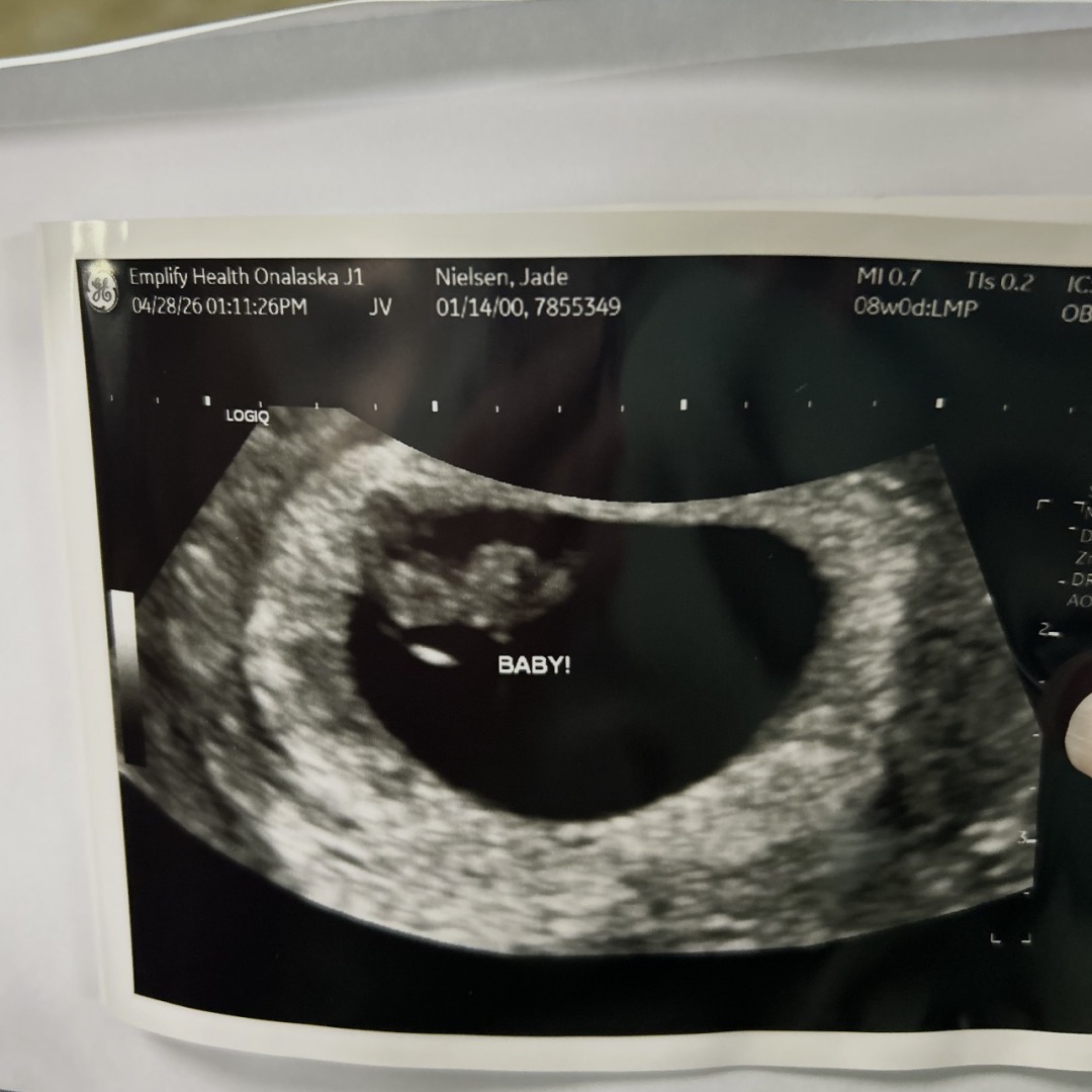 Photo shared by Jade for their Babylist baby registry.