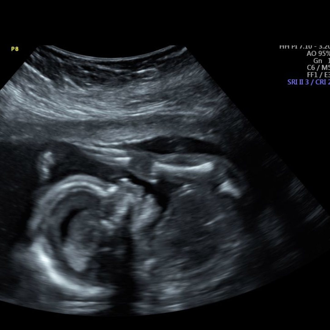 Photo shared by Hailey for their Babylist baby registry.