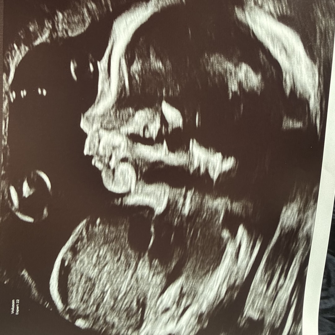 Photo shared by Cecilia for their Babylist baby registry.