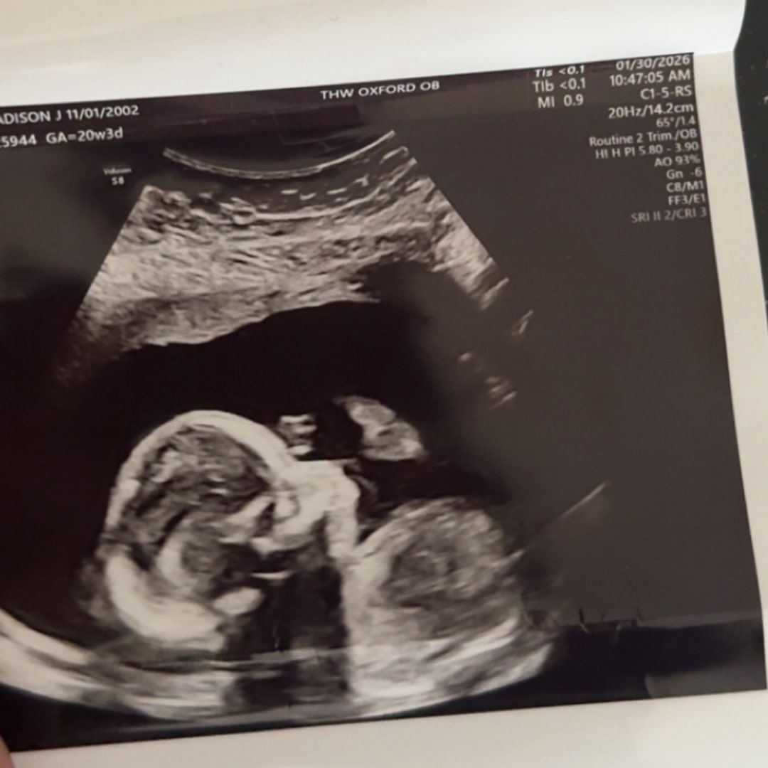 Photo shared by Maddie for their Babylist baby registry.