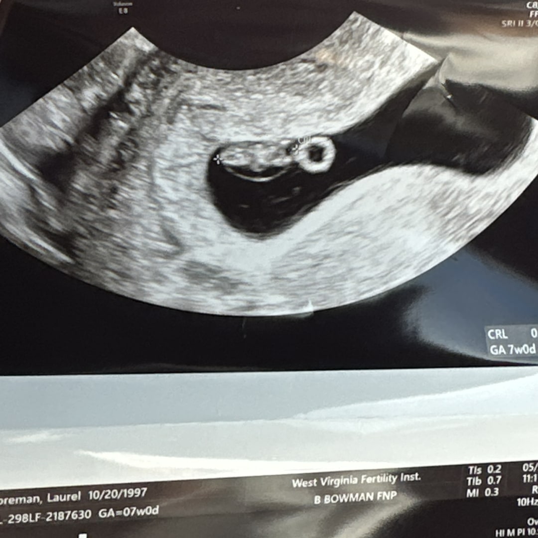 Photo shared by Laurel for their Babylist baby registry.