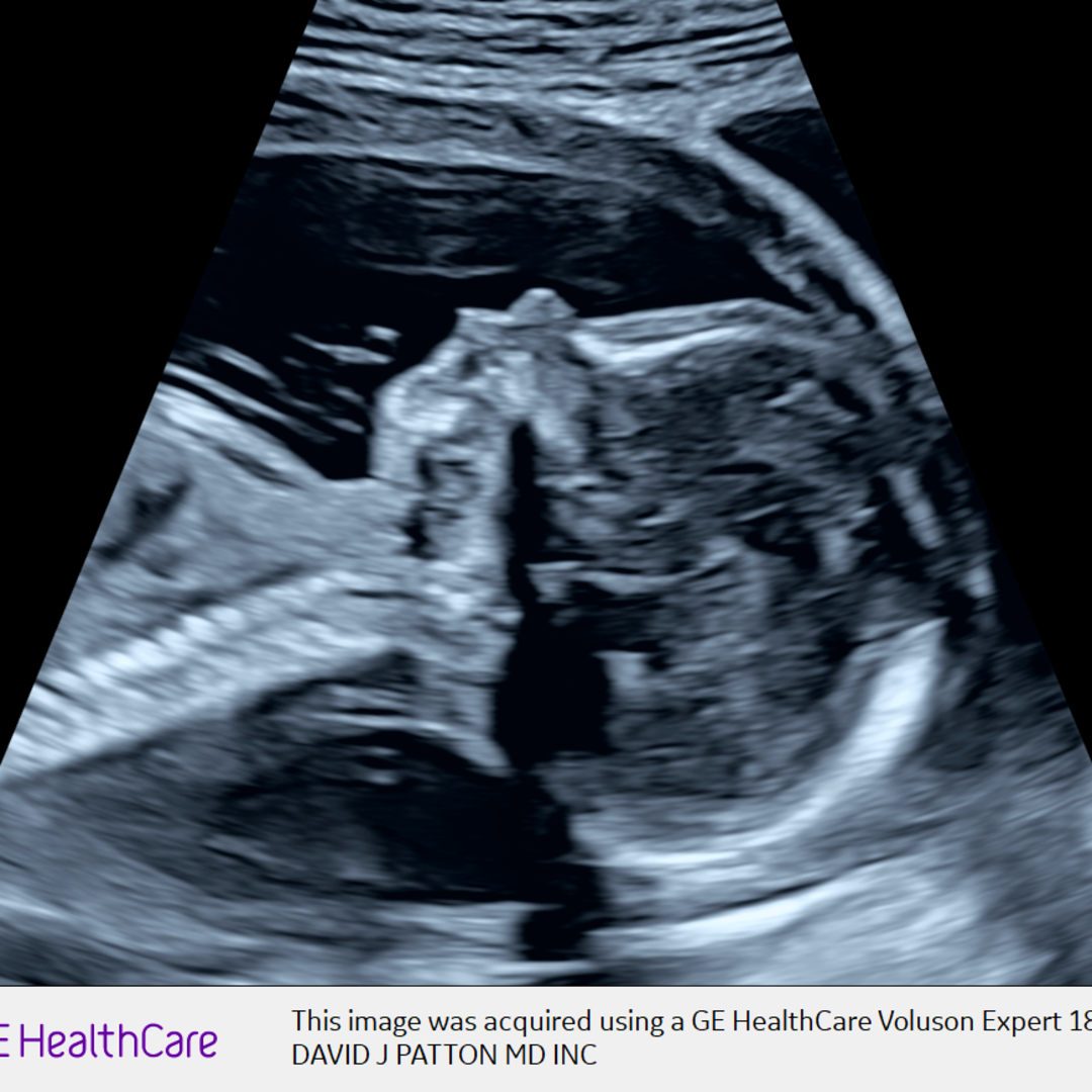 Photo shared by Christopher for their Babylist baby registry.