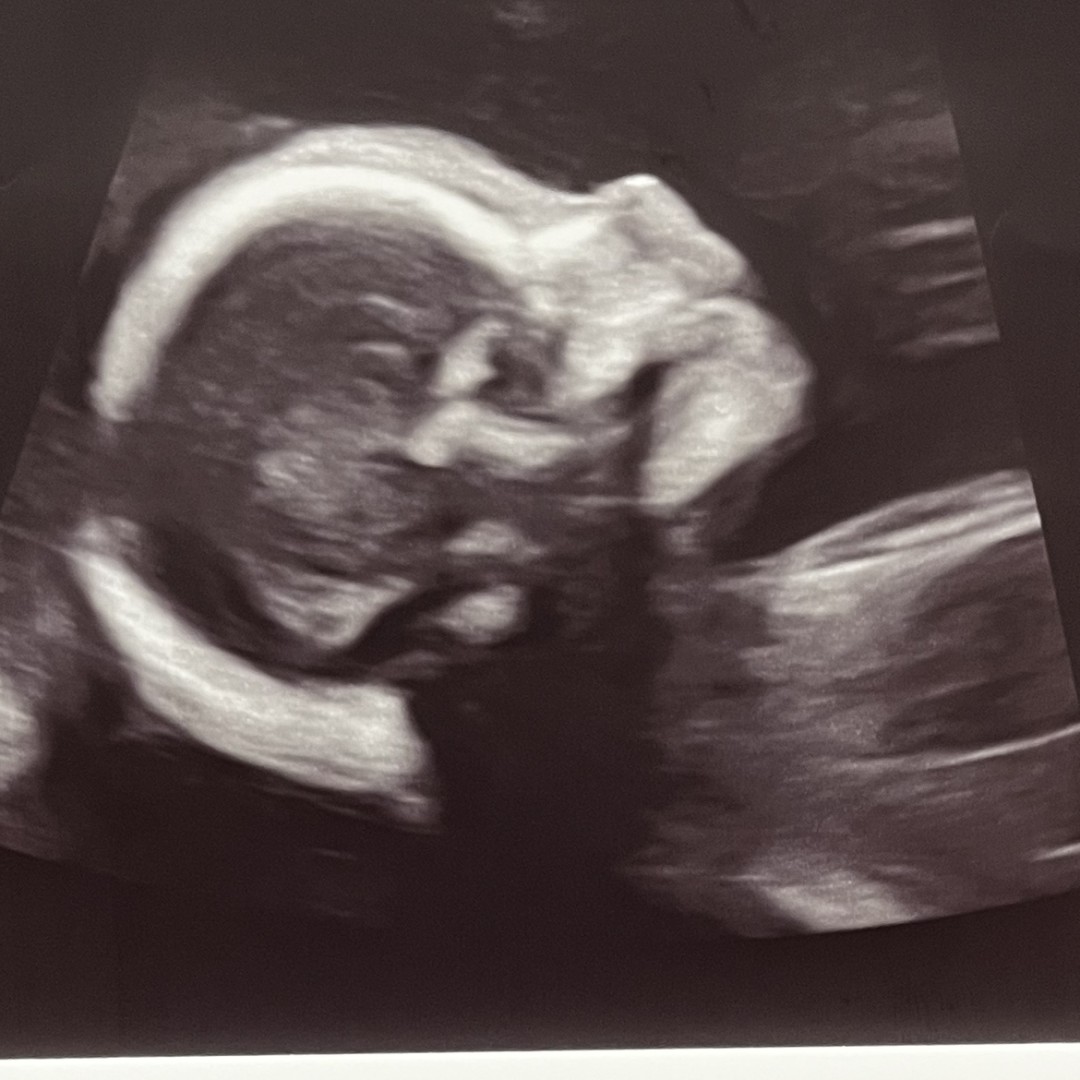 Photo shared by Brittney for their Babylist baby registry.