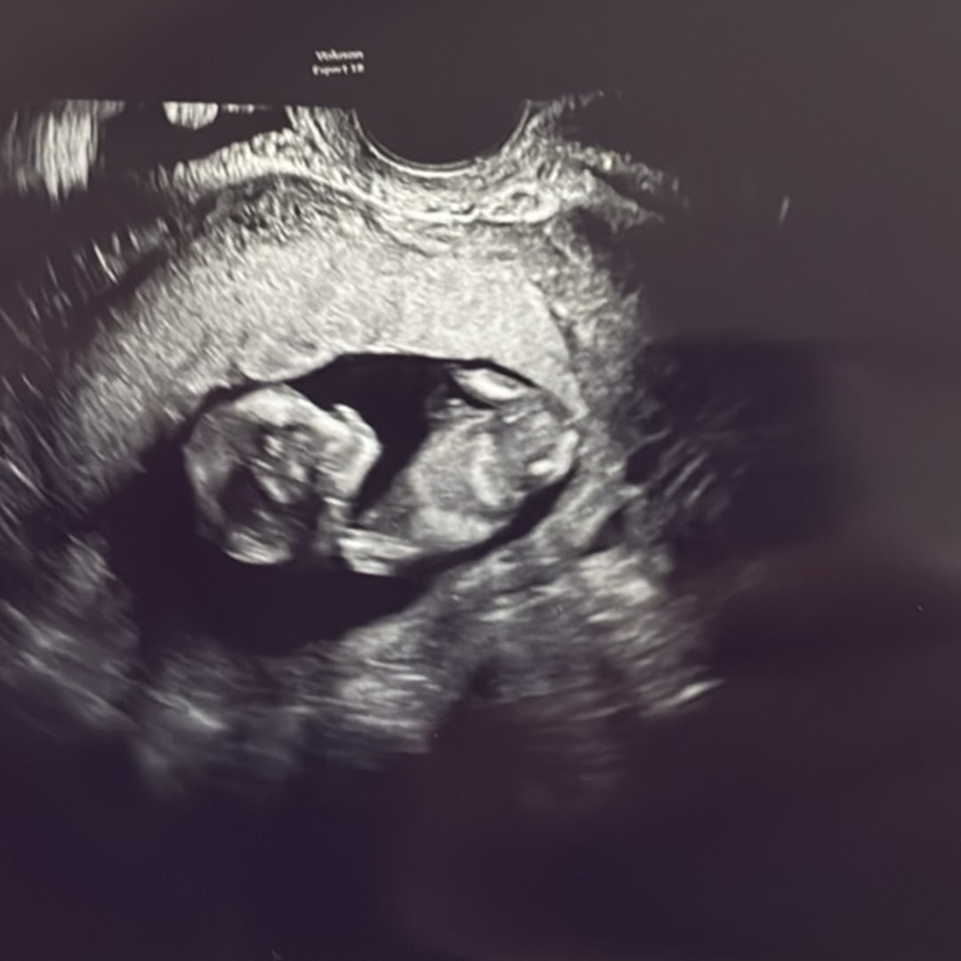 Photo shared by Cassey for their Babylist baby registry.